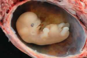 Human Embryo surah Rahman of Holy Quran